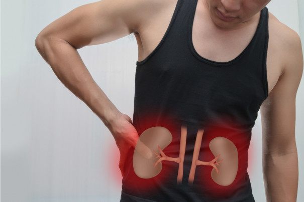 Kidney failures requires frequent kidney dialysis